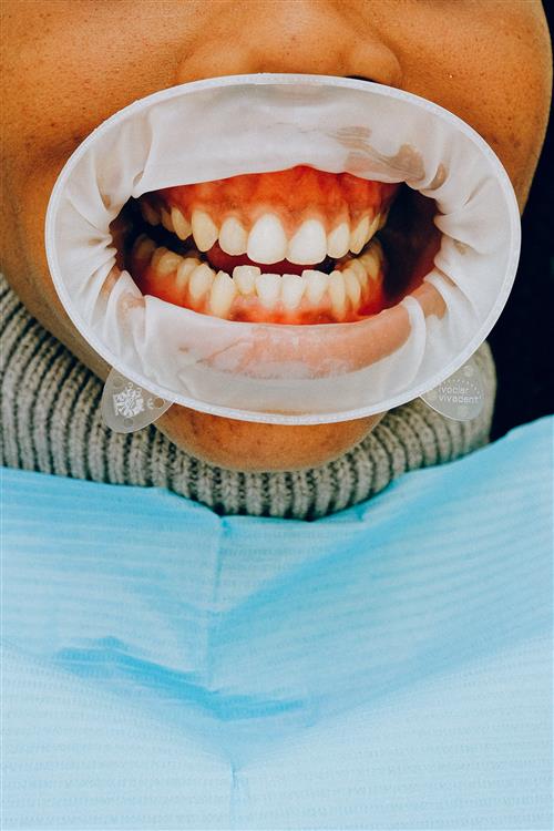Paediatric dentistry treatment